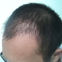發(fā)際線用戶圖片