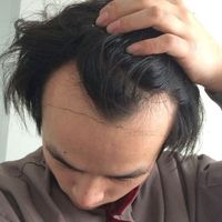 發(fā)際線用戶圖片