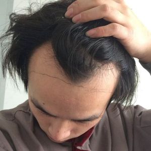发际线分享社区