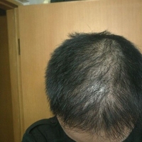 <font color="red">稀少加密</font>用戶圖片