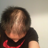 <font color="red">稀少加密</font>用戶圖片