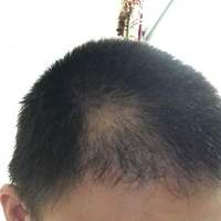 發(fā)際線用戶圖片