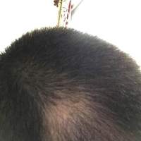 發(fā)際線用戶圖片