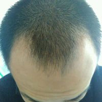 發(fā)際線用戶圖片