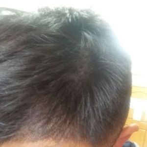 发际线分享社区