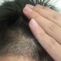 發(fā)際線用戶圖片