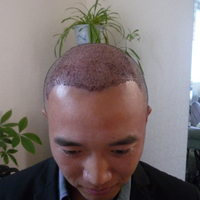 發(fā)際線用戶圖片