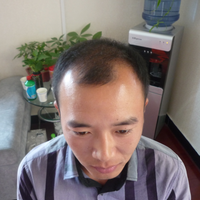 發(fā)際線用戶圖片