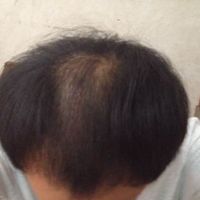 禿頂用戶圖片