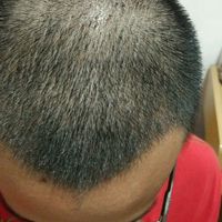 發(fā)際線用戶圖片