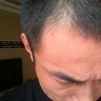 發(fā)際線用戶圖片