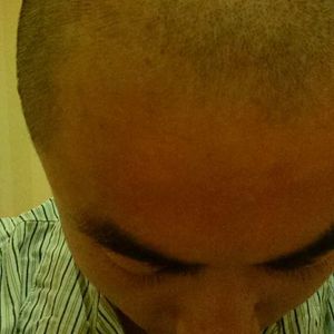 发际线分享社区