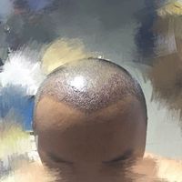 發(fā)際線用戶圖片