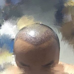 发际线分享社区
