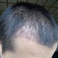 發(fā)際線用戶圖片