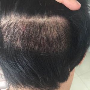 稀少加密分享社区