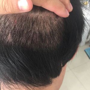 稀少加密分享社区