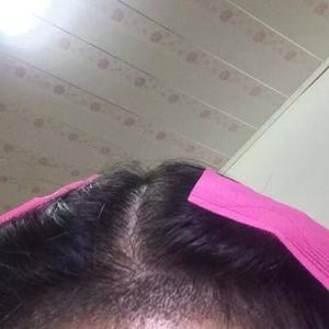发际线分享社区