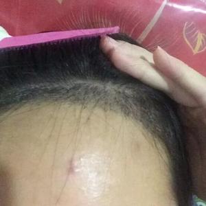发际线分享社区