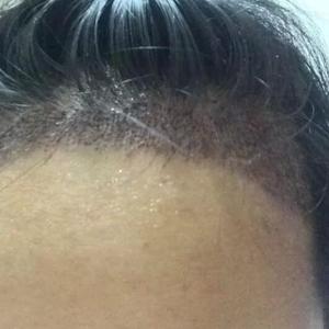 发际线分享社区
