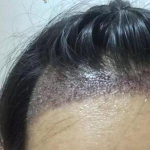 发际线分享社区