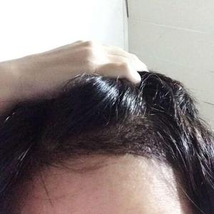 发际线分享社区