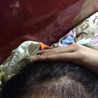 發(fā)際線用戶圖片