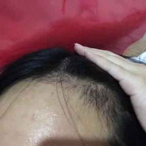 发际线分享社区