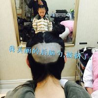 發(fā)際線用戶圖片