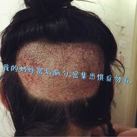 發(fā)際線用戶圖片