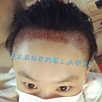 發(fā)際線用戶圖片
