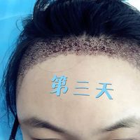 發(fā)際線用戶圖片