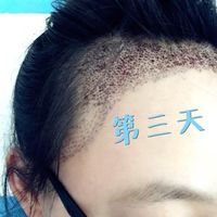 發(fā)際線用戶圖片