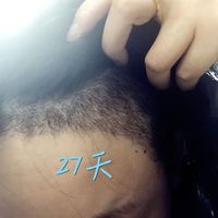 發(fā)際線用戶圖片