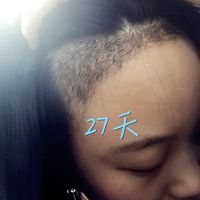 發(fā)際線用戶圖片