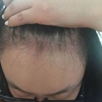 發(fā)際線用戶圖片