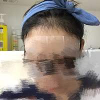 發(fā)際線用戶圖片