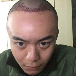 发际线分享社区