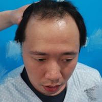 發(fā)際線用戶圖片