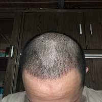 發(fā)際線用戶圖片