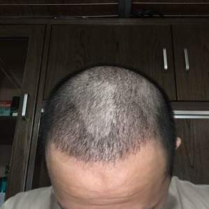 发际线分享社区