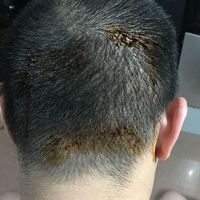 發(fā)際線用戶圖片