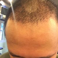 發(fā)際線用戶圖片