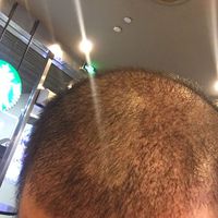 發(fā)際線用戶圖片