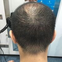 發(fā)際線用戶圖片
