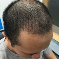 發(fā)際線用戶圖片