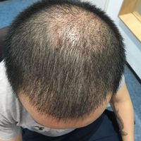 發(fā)際線用戶圖片
