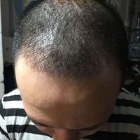 發(fā)際線用戶圖片
