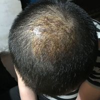 發(fā)際線用戶圖片