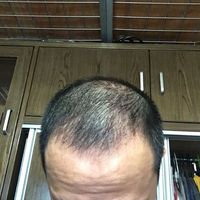 發(fā)際線用戶圖片